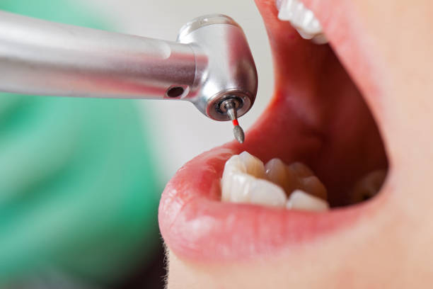Best Walk-In Emergency Dentist in New Carlisle, OH